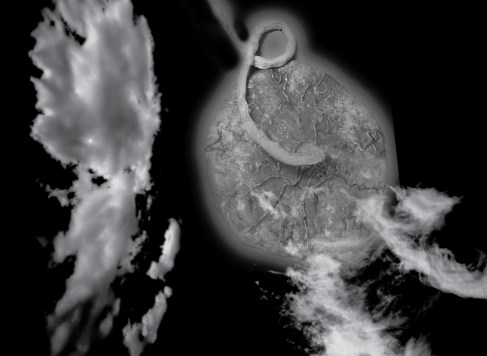 An abstract interstitial image with clouds and a floating placenta